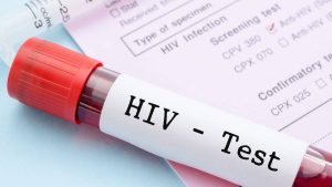 Pandemia de Aids pode acabar até 2030, diz estudo da ONU
