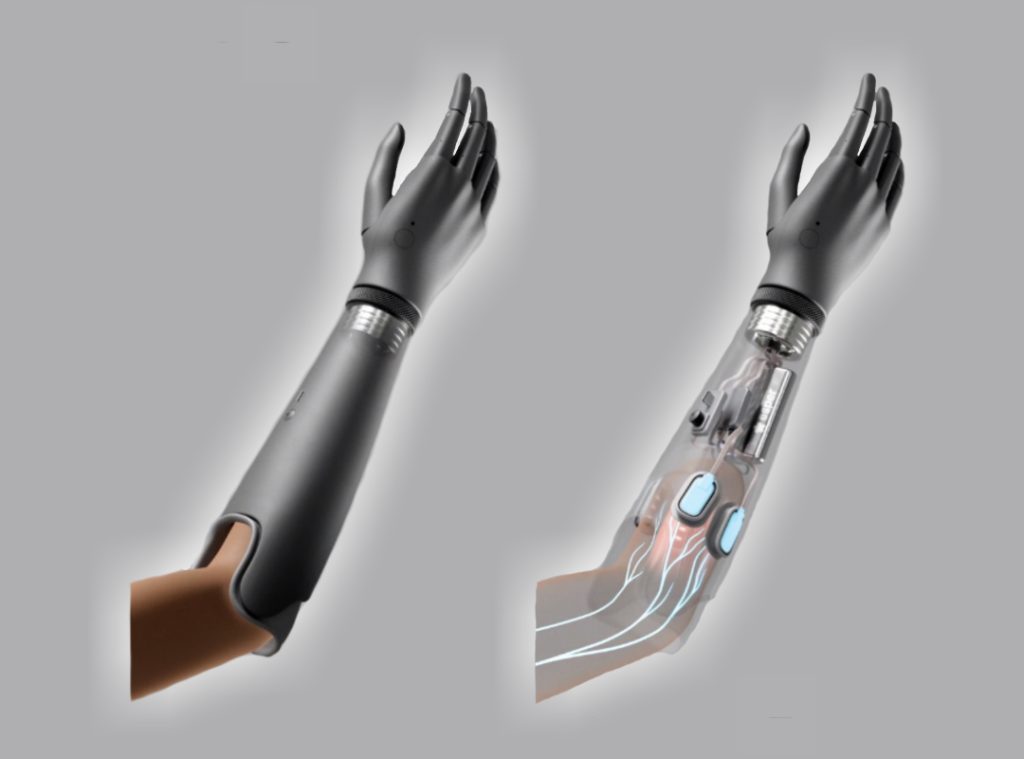protese mao bionica revolucao inteligencia artificial ascenda digital noticias 1
