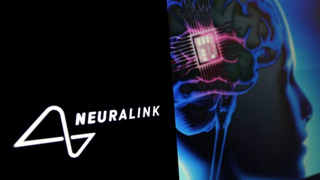 neuralink 1 1536x864 1