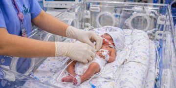 Hospital Universitário Santa Terezinha mobiliza comunidade para doações via Imposto de Renda que ajudam a salvar vidas de crianças 3 hust